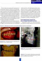 Высота окклюзии в протезировании и ортогнатологии. Клиническое руководство по цифровой стоматологии. Комплект из 2 книг - Фото 4