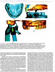 Высота окклюзии в протезировании и ортогнатологии. Клиническое руководство по цифровой стоматологии. Комплект из 2 книг - Фото 13