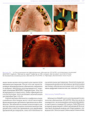 Высота окклюзии в протезировании и ортогнатологии. Клиническое руководство по цифровой стоматологии. Комплект из 2 книг - Фото 14