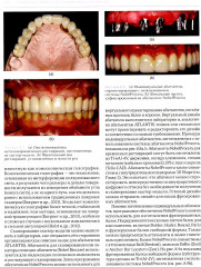 Высота окклюзии в протезировании и ортогнатологии. Клиническое руководство по цифровой стоматологии. Комплект из 2 книг - Фото 15