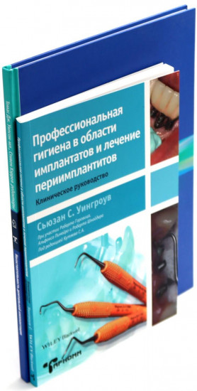 Профессиональная гигиена в области имплантатов и лечение периимплантитов. Несостоятельность дентальной имплантации