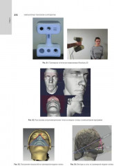 Ортодонтия. Комплект из 2 книг - Фото 3