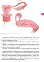 Справочник гинеколога-эндокринолога. Патологическая анатомия акушерских заболеваний. Комплект из 2 книг - Фото 8