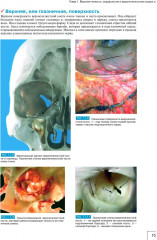 Атлас анатомии зубочелюстной системы для имплантологов - Фото 6