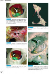Атлас анатомии зубочелюстной системы для имплантологов - Фото 7