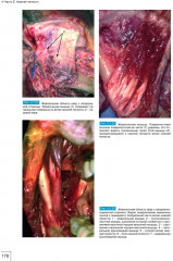 Атлас анатомии зубочелюстной системы для имплантологов - Фото 9