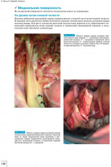 Атлас анатомии зубочелюстной системы для имплантологов - Фото 11
