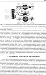 Гнойно-воспалительные заболевания головы и шеи. Этиология, патогенез, клиника, лечение - Фото 8