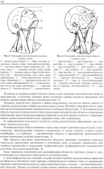 Гнойно-воспалительные заболевания головы и шеи. Этиология, патогенез, клиника, лечение - Фото 9