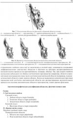 Гнойно-воспалительные заболевания головы и шеи. Этиология, патогенез, клиника, лечение - Фото 10