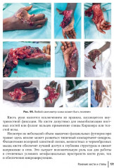 Хирургия в условиях ограниченных ресурсов: лечение огнестрельных ранений конечностей. Иллюстрированное руководство - Фото 5