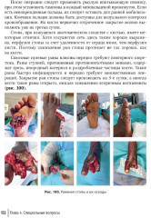 Хирургия в условиях ограниченных ресурсов: лечение огнестрельных ранений конечностей. Иллюстрированное руководство - Фото 6