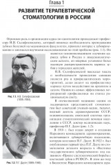 Терапевтическая стоматология - Фото 7