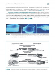 Судебно-медицинская экспертиза огнестрельной травмы - Фото 2