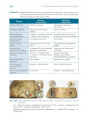 Судебно-медицинская экспертиза огнестрельной травмы - Фото 3