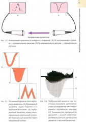 Руководство по электрокардиографии. ЭхоКГ понятным языком. Комплект из 2 книг - Фото 14