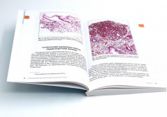 Интерпретация биопсий пищеварительного тракта. Комплект из 2 книг - Фото 2