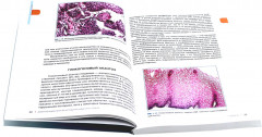 Интерпретация биопсий пищеварительного тракта. Комплект из 2 книг - Фото 4