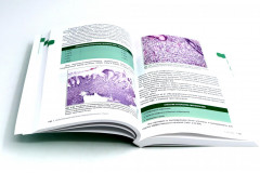 Интерпретация биопсий пищеварительного тракта. Комплект из 2 книг - Фото 7