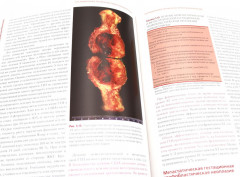 Клиническая онкогинекология. В 3 томах. Комплект из 3 книг - Фото 3