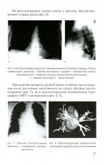 Методика обследования кардиохирургического больного перед операцией на сердце. Основы кардиохирургии для менеджеров, не имеющих медицинского образования. Комплект из 2 книг - Фото 2