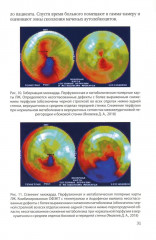 Методика обследования кардиохирургического больного перед операцией на сердце. Основы кардиохирургии для менеджеров, не имеющих медицинского образования. Комплект из 2 книг - Фото 3