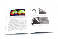 Методика обследования кардиохирургического больного перед операцией на сердце. Основы кардиохирургии для менеджеров, не имеющих медицинского образования. Комплект из 2 книг - Фото 6