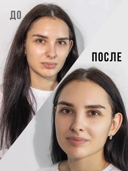 Гель для умывания лица с ниацинамидом и цинком «Anti Acne»
