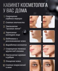 Массажер микротоковый для RF-лифтинга - Фото 4