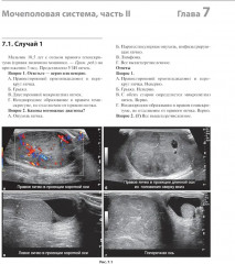 Детская радиология. Сложные случаи - Фото 8