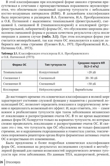 Отосклероз
