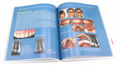 Ортодонтия и пародонтология. Мукогингивальная хирургия вокруг зубов и имплантатов. Комплект из 2 книг - Фото 2