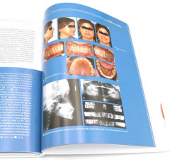 Ортодонтия и пародонтология. Мукогингивальная хирургия вокруг зубов и имплантатов. Комплект из 2 книг - Фото 6