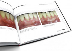 Ортодонтия и пародонтология. Мукогингивальная хирургия вокруг зубов и имплантатов. Комплект из 2 книг - Фото 8