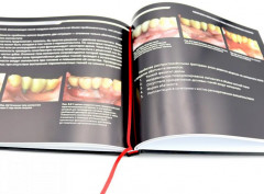 Ортодонтия и пародонтология. Мукогингивальная хирургия вокруг зубов и имплантатов. Комплект из 2 книг - Фото 11