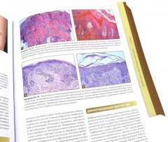 Дерматология Фицпатрика в клинической практике. Комплект из 3 книг - Фото 5