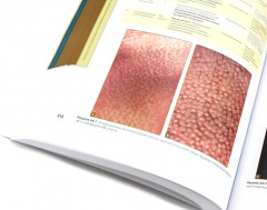 Дерматология Фицпатрика в клинической практике. Комплект из 3 книг - Фото 7