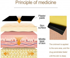 Обезболивающие пластыри с тигровым бальзамом - Фото 6
