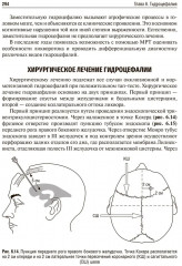 Основы нейрохирургии - Фото 17