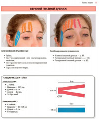 Нейромышечное тейпирование. Лечение отеков, гематом и рубцов - Фото 11