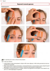 Нейромышечное тейпирование. Лечение отеков, гематом и рубцов - Фото 12