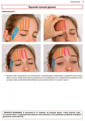 Нейромышечное тейпирование. Лечение отеков, гематом и рубцов - Фото 13