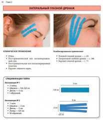 Нейромышечное тейпирование. Лечение отеков, гематом и рубцов - Фото 14