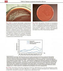 Атлас детских инфекционных заболеваний - Фото 15