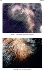 Лечение волос и кожи головы - Фото 3