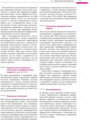 Поражения периферических нервов и корешковые синдромы - Фото 11