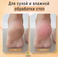 Терка педикюрная из нано-стекла - Фото 2