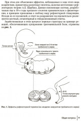 Точечная электростимуляция в практике медицинской реабилитации - Фото 4
