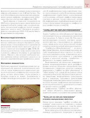 Сосудистые осложнения в реконструктивной микрохирургии - Фото 7