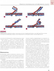 Сосудистые осложнения в реконструктивной микрохирургии - Фото 10